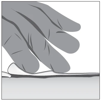 A hand pressing with fingers on a slightly raised skin surface to prepare the