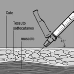Diagrama médico que muestra la