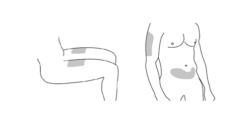 Dibujo esquemático de un cuerpo humano que muestra las zonas de aplicación del medicamento en el muslo y el abdomen