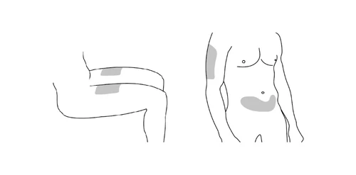Dibujo esquemático de un cuerpo humano que muestra las zonas de aplicación del medicamento