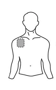 Dibujo lineal de un torso masculino con un círculo gris punteado situado en la parte superior del brazo derecho para la