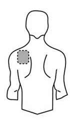 Dibujo esquemático del torso de un hombre visto de espalda con un círculo gris punteado que indica la zona de aplicación en el hombro izquierdo