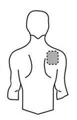 Dibujo esquemático del torso humano visto de espalda con un círculo gris punteado situado en la parte superior del hombro derecho