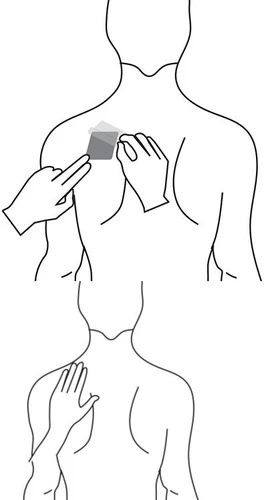 Dibujo esquemático de un torso humano que muestra dos manos aplicando un parche en el pecho y una mano tocando la parte superior de la espalda
