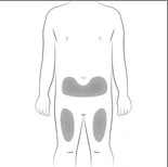 Esquema del cuerpo humano que muestra áreas grises en la parte inferior del abdomen