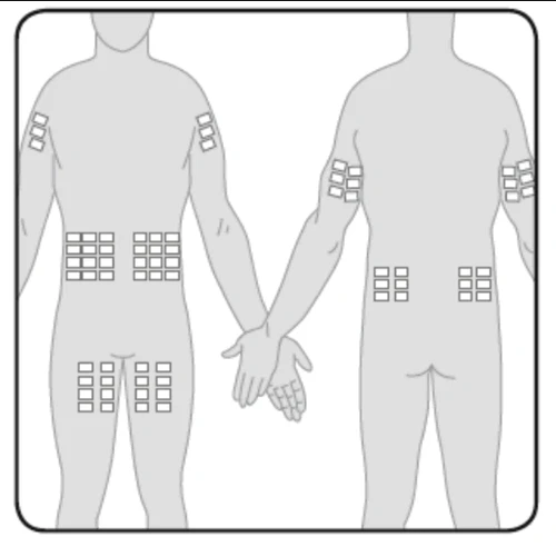 Dibujo estilizado de dos figuras humanas que muestran la posición de parches aplicados en brazos, abdomen y muslos para un tratamiento médico