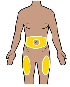 Diagram of a male body with three yellow areas highlighted for the