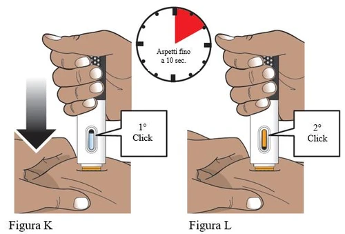 Medical illustration showing the