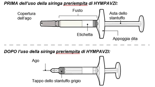 Medical diagram showing a syringe prior to
