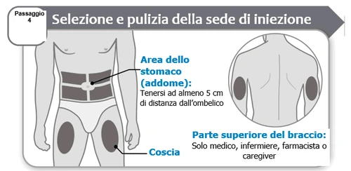 Medical diagram indicating injection sites on the