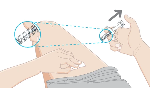 Medical illustration showing a hand holding a medical device for
