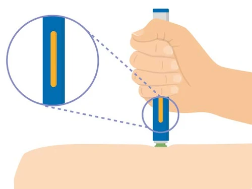 Una mano sostiene un dispositivo médico azul y blanco sobre un brazo, con una ampliación que muestra una ventana amarilla en el cuerpo del dispositivo