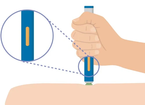 Una mano sostiene un dispositivo médico azul y blanco apoyado sobre la piel del brazo con una ampliación que muestra una ventana naranja