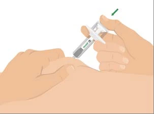 Dos manos que utilizan un dispositivo médico autoinyector en la parte superior del brazo con una flecha verde que indica la dirección de presión