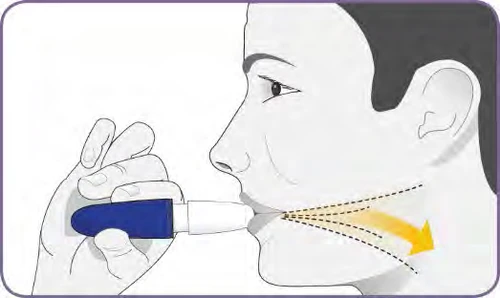 Dibujo de una persona que sostiene un inhalador en la boca con una flecha amarilla que indica el paso del medicamento hacia la garganta