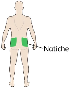 Diagrama del cuerpo humano visto desde atrás con las áreas de las nalgas resaltadas en verde y una línea que indica la inscripción Nalgas