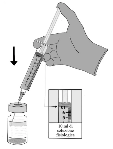 Una mano enguantada tiene una jeringa para aspirar 10 ml de solución fisiológica de un frasco de vidrio, con un detalle ampliado que muestra la graduación de la dosis