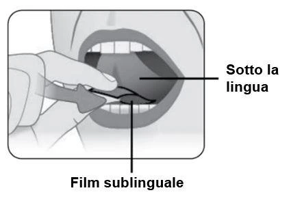 Medical illustration showing a hand placing a thin sublingual film under the tongue of an open-mouthed person