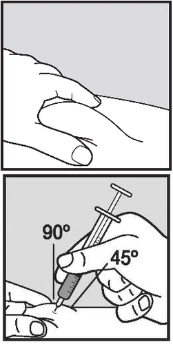 Dibujo médico que muestra una mano pellizcando la piel y una jeringa insertada con un ángulo de 45 grados respecto a la superficie cutánea