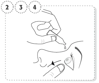 Dibujo lineal de una mano que utiliza un cuentagotas para aplicar una gota de líquido sobre el ojo