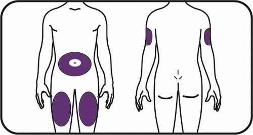 Diagrama de dos figuras humanas que muestran las zonas de aplicación del medicamento en el