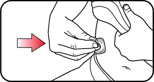 Dibujo en blanco y negro que muestra dos manos aplicando una tirita médica sobre la piel del tronco con una flecha roja dirigida hacia la derecha