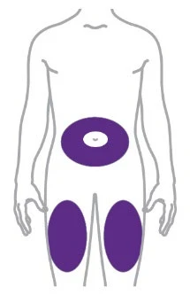 Esquema del cuerpo humano con tres áreas moradas resaltadas en el