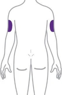 Dibujo estilizado del torso humano visto desde atrás con dos áreas rectangulares moradas colocadas en la parte superior de ambos brazos