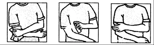 Three sequential drawings showing a person applying a medical device to the arm for a