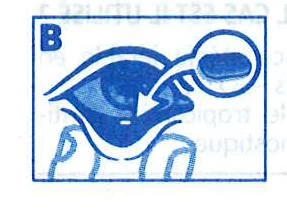 Diagrama médico azul que muestra un ojo con una flecha que indica la