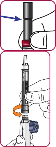 Ilustración médica que muestra dos pasos: una mano presiona la parte superior de un dispositivo y un