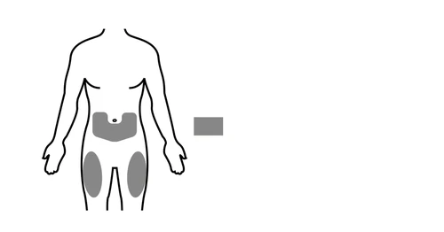 Esquema estilizado de un cuerpo humano con tres áreas grises que indican los sitios de inyección en