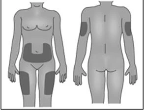 Medical diagram showing two human figures, one anterior and one posterior, with dark areas highlighted on the body