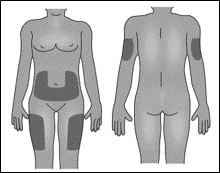 Diagram of the human body showing dark areas applied on specific regions