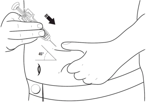 Technical drawing showing a hand inserting a syringe into the