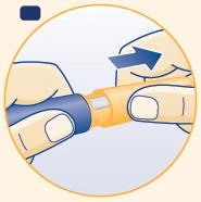 Dos manos sostienen un dispositivo médico cilíndrico azul y naranja y lo separan con un movimiento hacia afuera