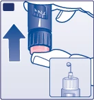Medical illustration showing a hand pushing downward on a device