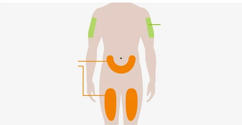 Human body diagram with green areas on the arms and orange areas on the