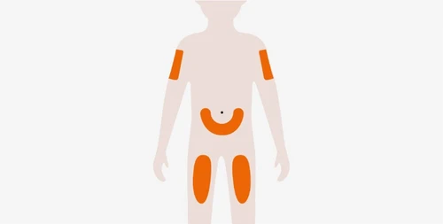 Stylized silhouette of a human body with highlighted orange areas on the arms, on the