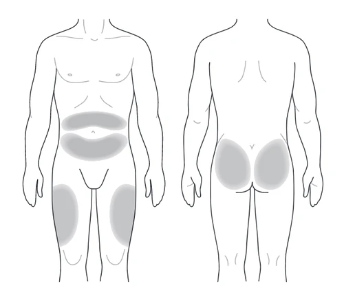 Diagram of two male figures showing gray areas on the