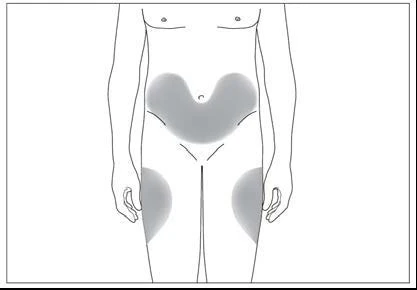 Dibujo esquemático de un torso humano con áreas grises que indican zonas de aplicación para la inyección