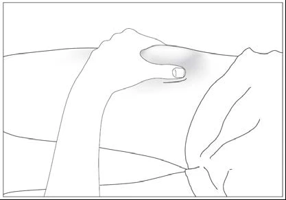 Una mano presiona con el pulgar sobre la piel de la zona abdominal para preparar el sitio de administración