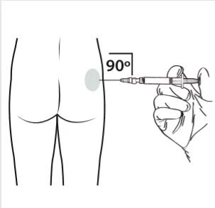 Schematic drawing of a hand holding a syringe to inject medication into the buttock at a 90-degree angle to the skin