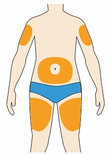 Human body diagram with orange zones on arms, on
