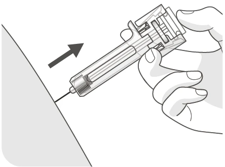 A hand holds an injection device with a needle penetrating a skin surface following the direction of a black arrow