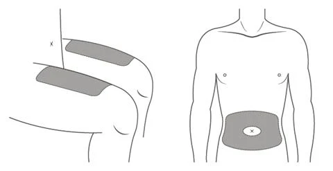Medical diagram showing the