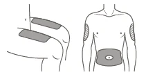Schematic drawing of a male torso with three gray circles indicating drug administration sites on arms and abdomen