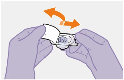 Two gloved hands handling a medical device with an orange curved arrow indicating a rotational or oscillating movement
