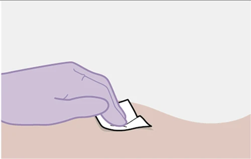 A purple-colored gloved hand gently lifting a small white adhesive patch applied to the skin of an arm or leg