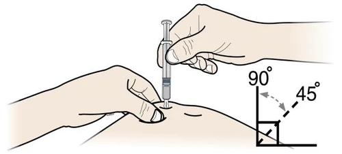 Una mano sostiene una jeringa para inyectar un medicamento en un brazo mientras la